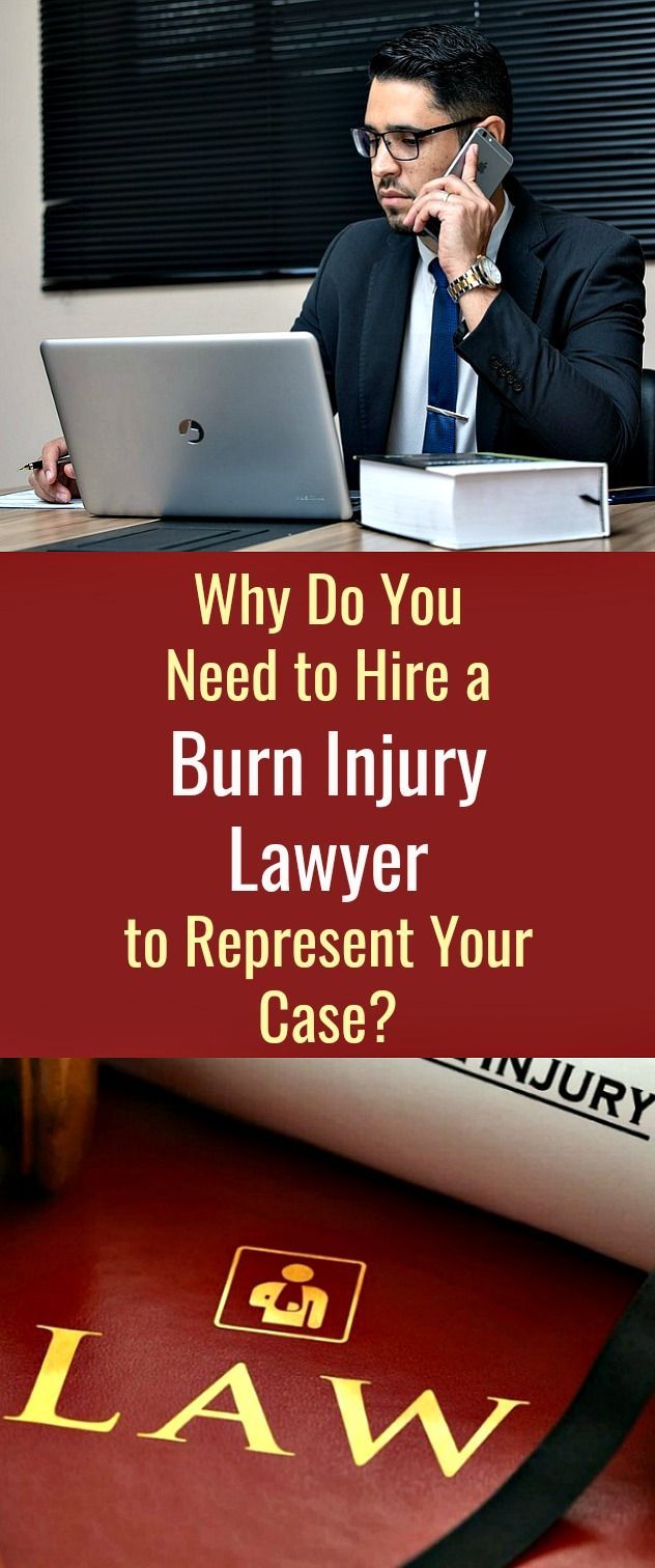 Discover How Burn Injury Attorneys Can Transform Your Case Discover How Burn Injury Attorneys Can Transform Your Case